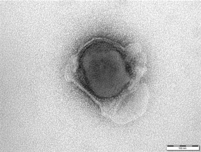 Vaccination With a Gamma Irradiation-Inactivated African Swine Fever Virus Is Safe But Does Not Protect Against a Challenge